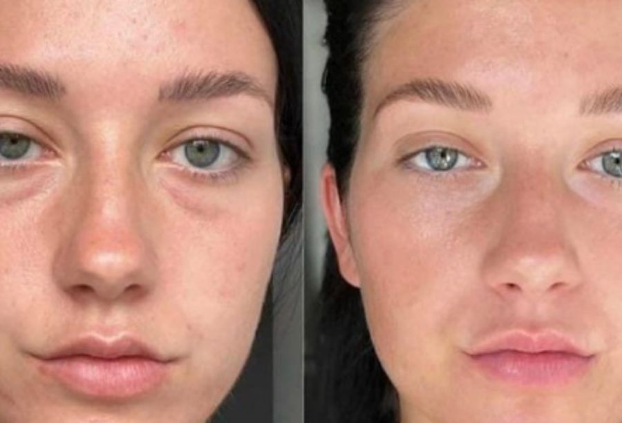 Before / After